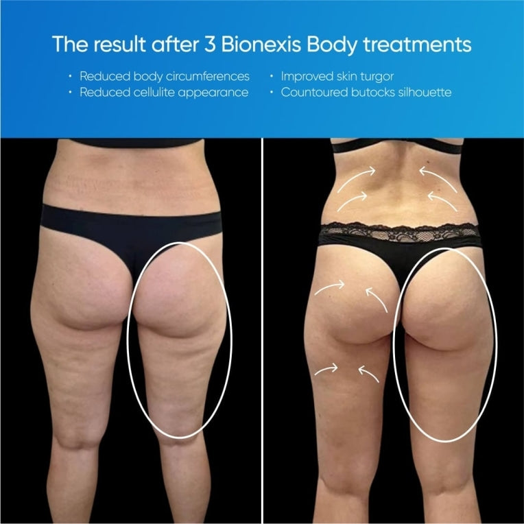 Zemits Bionexis Lite Pro Contouringssysteem
