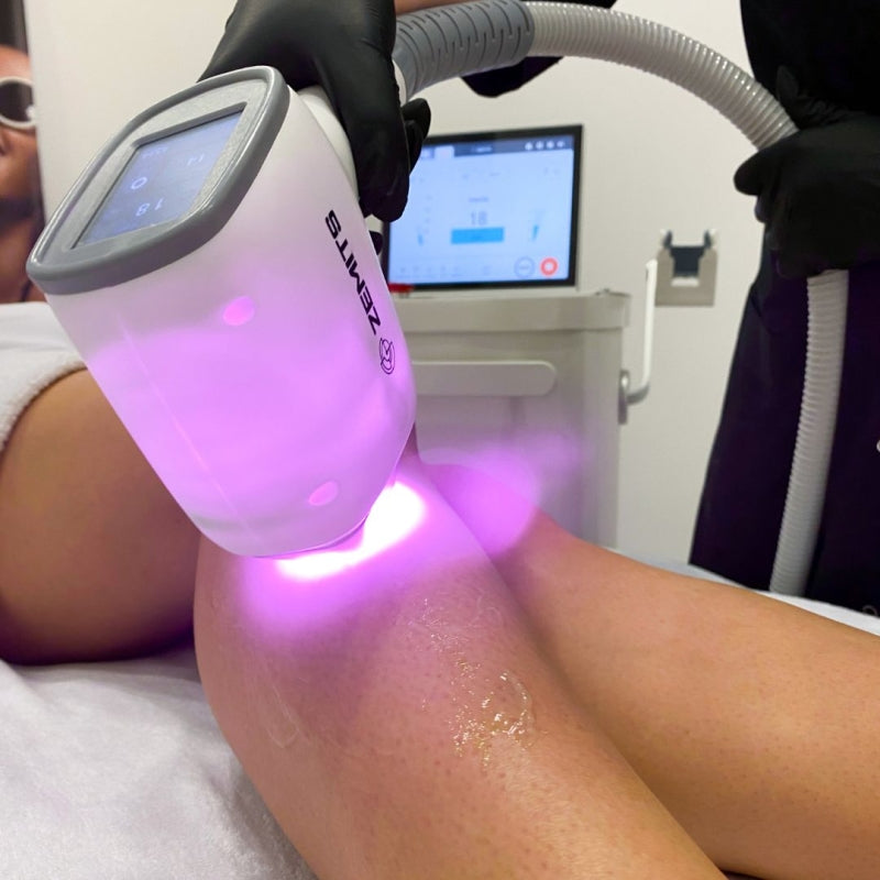 Zemits Quidion Diodelaser voor ontharing