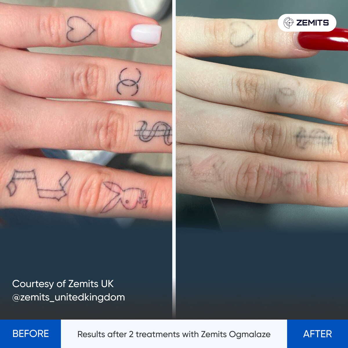 Before After Slide 2