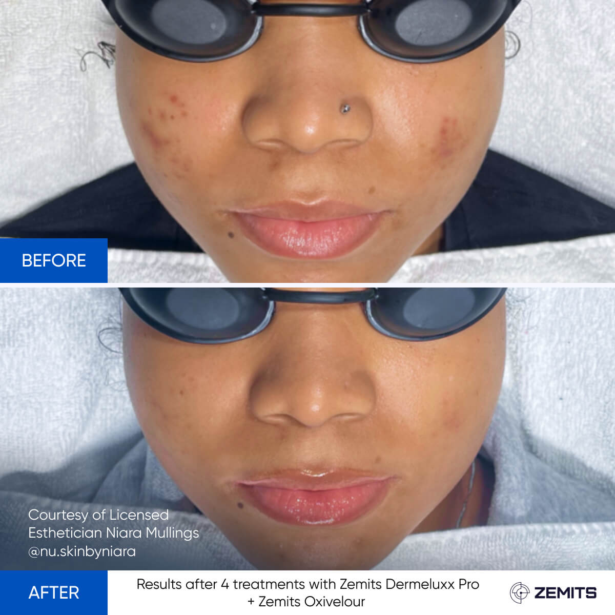 Before After Slide 1
