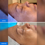 Zemits OxiVelour Pro