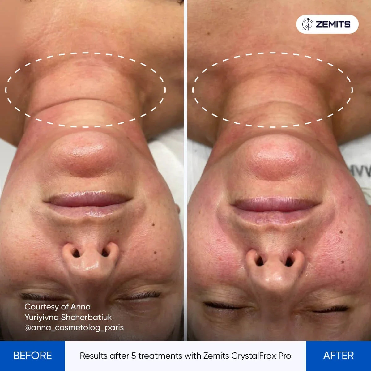 Before After Slide 6