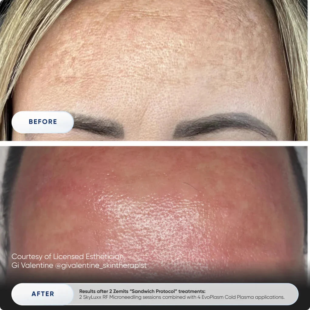 Before After Slide 2