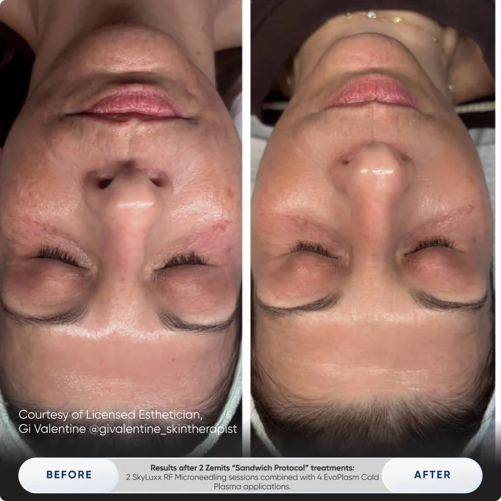 Before After Slide 7